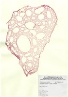 藏品(紅網海膜)的圖片